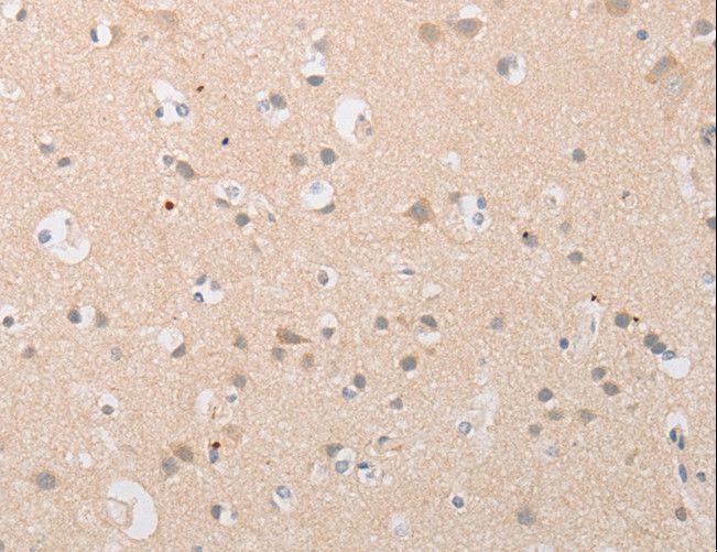 ATG9A Antibody - Immunohistochemistry of paraffin-embedded Human brain using ATG9A Polyclonal Antibody at dilution of 1:40.