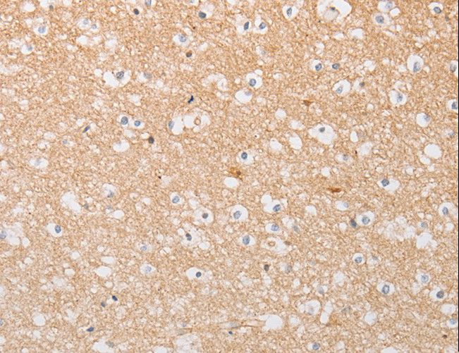 ATG9A Antibody - Immunohistochemistry of paraffin-embedded Human brain using ATG9A Polyclonal Antibody at dilution of 1:30.