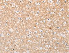 ATG9A Antibody - Immunohistochemistry of paraffin-embedded Human brain using ATG9A Polyclonal Antibody at dilution of 1:30.