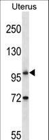ATG9B Antibody - ATG9B Antibody western blot of human normal Uterus tissue lysates (35 ug/lane). The ATG9B antibody detected the ATG9B protein (arrow).