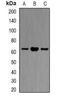 ATL1 Antibody - Western blot analysis of Atlastin-1 expression in LOVO (A); HEK293T (B); mouse brain (C) whole cell lysates.
