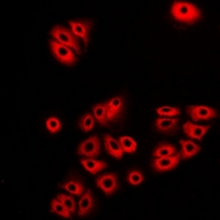 ATL1 Antibody - Immunofluorescent analysis of Atlastin-1 staining in A549 cells. Formalin-fixed cells were permeabilized with 0.1% Triton X-100 in TBS for 5-10 minutes and blocked with 3% BSA-PBS for 30 minutes at room temperature. Cells were probed with the primary antibody in 3% BSA-PBS and incubated overnight at 4 deg C in a humidified chamber. Cells were washed with PBST and incubated with a DyLight 594-conjugated secondary antibody (red) in PBS at room temperature in the dark.