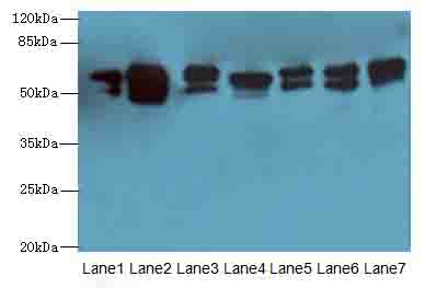 ATL2 Antibody - Western blot. All lanes: ATL2 antibody at 1 ug/ml. Lane 1: HepG-2 whole cell lysate. Lane 2: MCF7 whole cell lysate. Lane 3: HL60 whole cell lysate. Lane 4: K562 whole cell lysate. Lane 5: U251 whole cell lysate. Lane 6: A549 whole cell lysate. Lane 7: A431 whole cell lysate. Secondary Goat polyclonal to Rabbit IgG at 1:10000 dilution. Predicted band size: 66 kDa. Observed band size: 66 kDa.