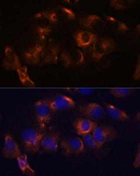ATL2 Antibody - Immunofluorescence analysis of C6 cells using ATL2 Polyclonal Antibody at dilution of 1:100.Blue: DAPI for nuclear staining.