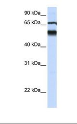 ATL3 Antibody - Fetal lung lysate. Antibody concentration: 1.0 ug/ml. Gel concentration: 12%.  This image was taken for the unconjugated form of this product. Other forms have not been tested.