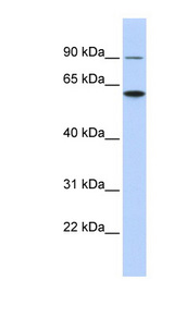 ATL3 Antibody - ATL3 antibody Western blot of HCT15 cell lysate. This image was taken for the unconjugated form of this product. Other forms have not been tested.