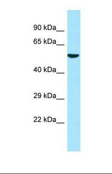 ATL3 Antibody - Western blot of Human 293T. ATL3 antibody dilution 1.0 ug/ml.  This image was taken for the unconjugated form of this product. Other forms have not been tested.