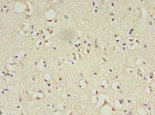 ATL3 Antibody - Immunohistochemistry of paraffin-embedded human brain tissue using antibody at 1:100 dilution.  This image was taken for the unconjugated form of this product. Other forms have not been tested.