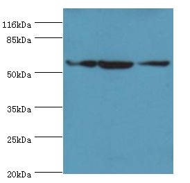 ATL3 Antibody - Western blot. All lanes: ATL3 antibody at 2 ug/ml Lane 1:Jurkat whole cell lysate. Lane 2: HeLa whole cell lysate Lane 3: HepG2 whole cell lysate. Secondary antibody: Goat polyclonal to rabbit at 1:10000 dilution. Predicted band size: 61 kDa. Observed band size: 61 kDa.  This image was taken for the unconjugated form of this product. Other forms have not been tested.
