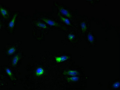 ATL3 Antibody - Immunofluorescent analysis of Hela cells using ATL3 Antibody at dilution of 1:100 and Alexa Fluor 488-congugated AffiniPure Goat Anti-Rabbit IgG(H+L)