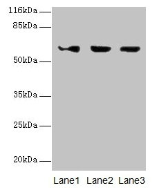ATL3 Antibody - Western blot All lanes: ATL3 antibody at 2µg/ml Lane 1: Jurkat whole cell lysate Lane 2: Hela whole cell lysate Lane 3: HepG2 whole cell lysate Secondary Goat polyclonal to rabbit IgG at 1/10000 dilution Predicted band size: 61 kDa Observed band size: 61 kDa
