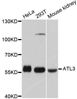 ATL3 Antibody - Western blot analysis of extracts of various cell lines, using ATL3 antibody at 1:1000 dilution. The secondary antibody used was an HRP Goat Anti-Rabbit IgG (H+L) at 1:10000 dilution. Lysates were loaded 25ug per lane and 3% nonfat dry milk in TBST was used for blocking. An ECL Kit was used for detection and the exposure time was 1s.