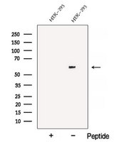 ATL3 Antibody - Western blot analysis of extracts of 3T3 cells using ATL3 antibody. The lane on the left was treated with blocking peptide.