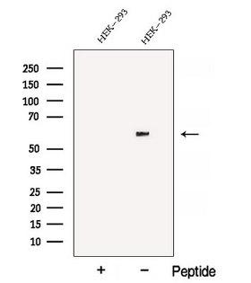 ATL3 Antibody - Western blot analysis of extracts of 3T3 cells using ATL3 antibody. The lane on the left was treated with blocking peptide.