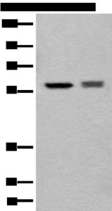 ATL3 Antibody - Western blot analysis of EPG2 and Jurkat cell lysates  using ATL3 Polyclonal Antibody at dilution of 1:800