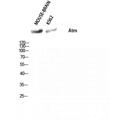 ATM Antibody - Western blot of Atm antibody
