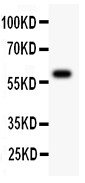 ATM Antibody - All lanes: Anti ATM at 0.5 ug/ml. WB: Recombinant Human ATM Protein 0.5ng. Predicted band size: 60 kD. Observed band size: 60 kD.