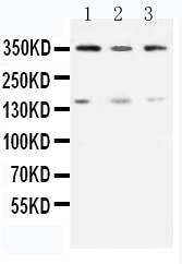 ATM Antibody - WB of ATM antibody. All lanes: Anti-ATM at 0.5ug/ml. Lane 1: Rat Testis Tissue Lysate at 40ug. Lane 2: U87 Whole Cell Lysate at 40ug. Lane 3: MCF-7 Whole Cell Lysate at 40ug. Predicted bind size: 350KD. Observed bind size: 350KD.