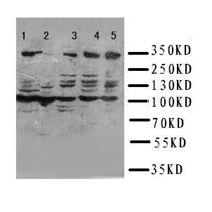 ATM Antibody - WB of ATM antibody. Lane 1: HELA Cell Lysate. Lane 2: SMMC Cell Lysate. Lane 3: U87 Cell Lysate . Lane 4: A549 Cell Lysate. Lane 5: MCF-7 Cell Lysate.