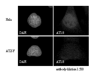ATM Antibody - Immunofluorescent staining using ATM antibody.  This image was taken for the unconjugated form of this product. Other forms have not been tested.