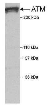 ATM Antibody - Detection of ATM in HeLa nuclear extracts using ATM antibody. Primary antibody: 1 ug/ml. Detection: 2 minute exposure.  This image was taken for the unconjugated form of this product. Other forms have not been tested.