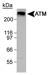 ATM Antibody - Immunohistochemical staining.  This image was taken for the unconjugated form of this product. Other forms have not been tested.