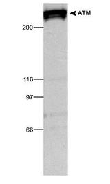 ATM Antibody - Western blot analysis using ATM antibody on an ATM and non-ATM patient sample. (1:1,000 primary dilution).  This image was taken for the unconjugated form of this product. Other forms have not been tested.