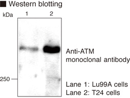 ATM Antibody