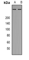 ATM Antibody - Western blot analysis of ATM expression in K562 (A); mouse brain (B) whole cell lysates.