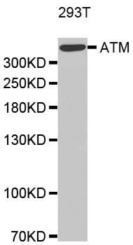 ATM Antibody - Western blot analysis of extracts of 293T cell lines.