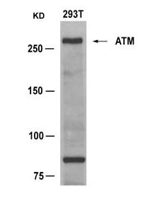 ATM Antibody - Western blot of extracts from 293T cells using ATM Antibody