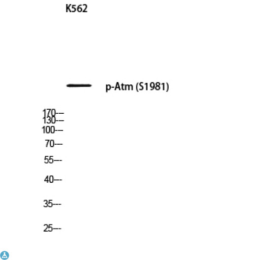 ATM Antibody - Western Blot (WB) analysis of K562 using p-Atm (S1981) antibody.