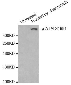 ATM Antibody - Western blot analysis of extracts of 293 cells.