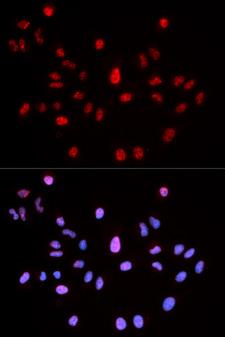 ATM Antibody - Immunofluorescence analysis of MCF7 cells.