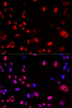 ATM Antibody - Immunofluorescence analysis of U2OS cells.