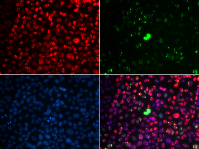ATM Antibody - Immunofluorescence analysis of GFP-RNF168 trangenic U2OS cells.