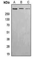 ATM Antibody - Western blot analysis of ATM (pS1981) expression in HeLa (A); Raw264.7 (B); H9C2 (C) whole cell lysates.