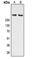 ATM Antibody - Western blot analysis of ATM (pS1981) expression in K562 (A); HEK293T UV-treated (B) whole cell lysates.