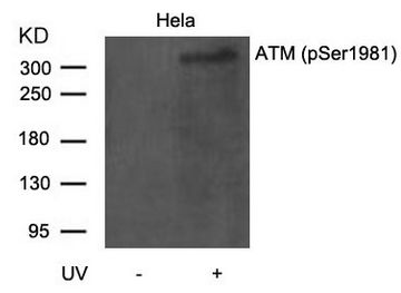 ATM Antibody - Western blot of extracts from HeLa cells untreated or treated with UV using ATM(Phospho-Ser1981) Antibody