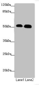 ATMIN Antibody - Western blot All Lanes: ATMIN antibody at 1.53ug/ml Lane 1: Hela whole cell lysate Lane 2: HepG-2 whole cell lysate Secondary Goat polyclonal to Rabbit IgG at 1/10000 dilution Predicted band size: 89,73 kDa Observed band size: 88 kDa,51 kDa