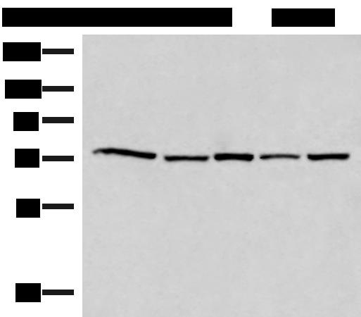 ATMIN Antibody - Western blot analysis of 293T Hela HepG2 231 and TM4 cell lysates  using ATMIN Polyclonal Antibody at dilution of 1:500