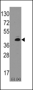 ATOH1 / MATH-1 Antibody - Western blot of ATOH1 (arrow) using rabbit polyclonal ATOH1 Antibody (Human N-term). 293 cell lysates (2 ug/lane) either nontransfected (Lane 1) or transiently transfected with the ATOH1 gene (Lane 2) (Origene Technologies).