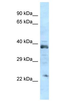 ATOH1 / MATH-1 Antibody - ATOH1 / MATH-1 antibody Western Blot of Rat Brain. Antibody dilution: 1 ug/ml.  This image was taken for the unconjugated form of this product. Other forms have not been tested.