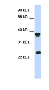 ATOH1 / MATH-1 Antibody - ATOH1 / MATH-1 antibody Western blot of Placenta lysate.