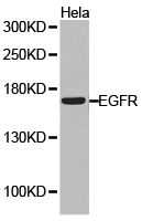 ATOH1 / MATH-1 Antibody - Western blot of extracts of HeLa cell lines, using EGFRantibody.