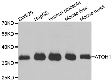ATOH1 / MATH-1 Antibody - Western blot analysis of extracts of various cell lines.