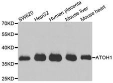 ATOH1 / MATH-1 Antibody - Western blot analysis of extracts of various cell lines.