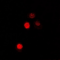 ATOH1 / MATH-1 Antibody - Immunofluorescent analysis of MATH-1 staining in U2OS cells. Formalin-fixed cells were permeabilized with 0.1% Triton X-100 in TBS for 5-10 minutes and blocked with 3% BSA-PBS for 30 minutes at room temperature. Cells were probed with the primary antibody in 3% BSA-PBS and incubated overnight at 4 deg C in a humidified chamber. Cells were washed with PBST and incubated with a DyLight 594-conjugated secondary antibody (red) in PBS at room temperature in the dark.