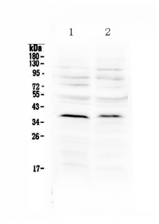 ATOH1 / MATH-1 Antibody - Western blot analysis of MATH1/HATH1 using anti-MATH1/HATH1 antibody. Electrophoresis was performed on a 5-20% SDS-PAGE gel at 70V (Stacking gel) / 90V (Resolving gel) for 2-3 hours. The sample well of each lane was loaded with 50ug of sample under reducing conditions. Lane 1: rat brain tissue lysate,Lane 2: mouse brain tissue lysate After Electrophoresis, proteins were transferred to a Nitrocellulose membrane at 150mA for 50-90 minutes. Blocked the membrane with 5% Non-fat Milk/ TBS for 1.5 hour at RT. The membrane was incubated with rabbit anti-MATH1/HATH1 antigen affinity purified polyclonal antibody at 0.5 µg/mL overnight at 4°C, then washed with TBS-0.1% Tween 3 times with 5 minutes each and probed with a goat anti-rabbit IgG-HRP secondary antibody at a dilution of 1:10000 for 1.5 hour at RT. The signal is developed using an Enhanced Chemiluminescent detection (ECL) kit with Tanon 5200 system. A specific band was detected for MATH1/HATH1 at approximately 38KD. The expected band size for MATH1/HATH1 is at 38KD.
