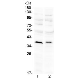 ATOH1 / MATH-1 Antibody - Western blot testing of 1) rat brain and 2) mouse brain with ATOH1 antibody at 0.5ug/ml. Predicted molecular weight ~38 kDa.